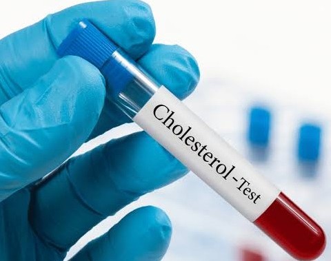 CHOLESTEROL TOTAL 